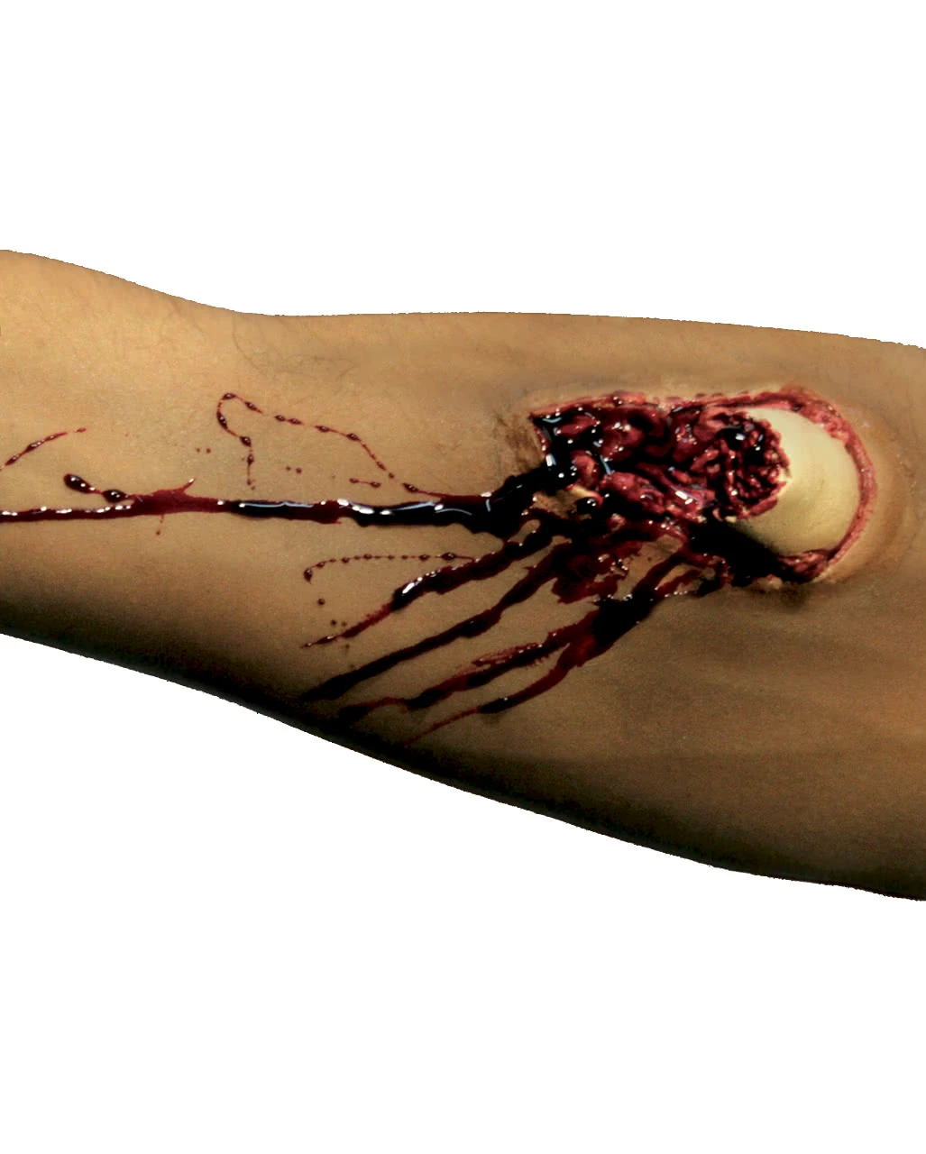 Blutige Knochenbruch Wunde 1 Blutige Knochenbruch Wunde